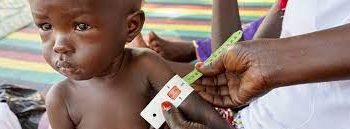 Conséquence de l’insécurité à Beni : des enfants menacés par une malnutrition aiguë en zone de santé de Mutwanga