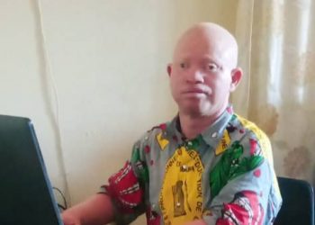 Burundi : au moins 10 albinos par province souffrent des maladies de la peau (Albinos sans frontières)