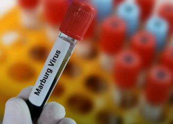 Nord-Kivu : les échantillons d&rsquo;Ebola reçus en zone de santé de Butembo « se sont révélés négatifs »
