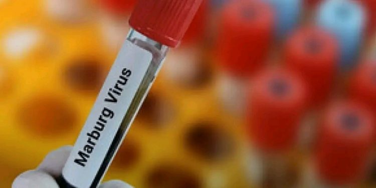 Nord-Kivu : les échantillons d&rsquo;Ebola reçus en zone de santé de Butembo « se sont révélés négatifs »