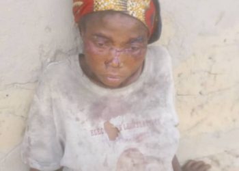 Sud-Kivu : une femme grièvement blessée par machette à Mwenga