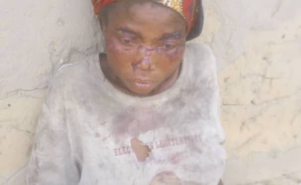 Sud-Kivu : une femme grièvement blessée par machette à Mwenga